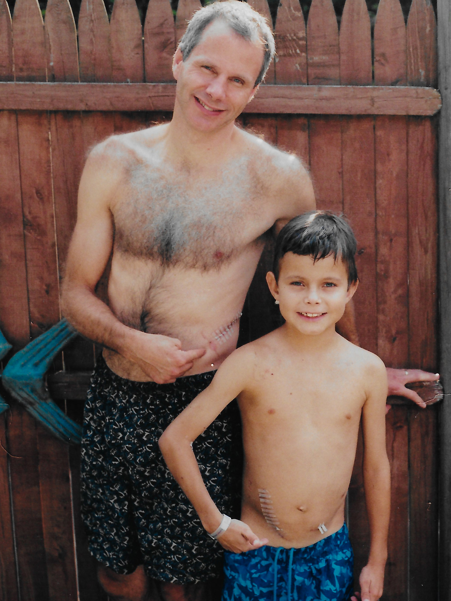 Ben and David standing outside 10 days after their transplant surgery